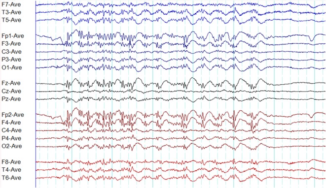 Figure 13