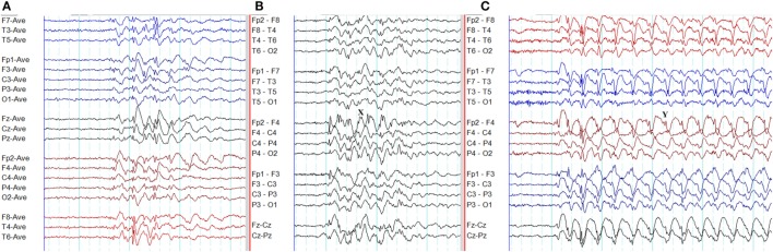 Figure 11