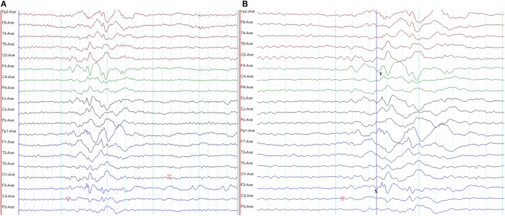 Figure 15