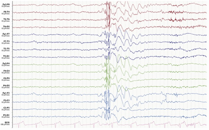 Figure 4