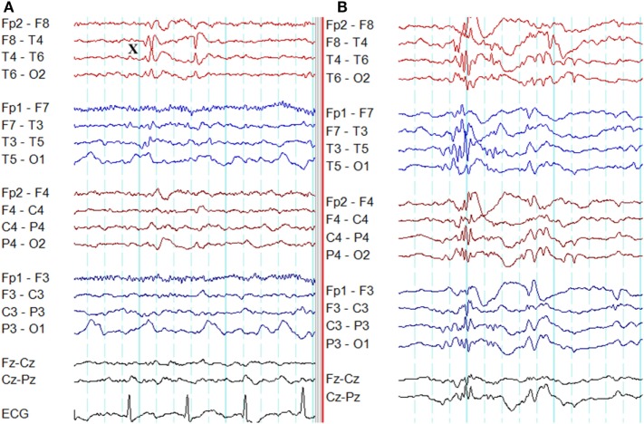 Figure 10