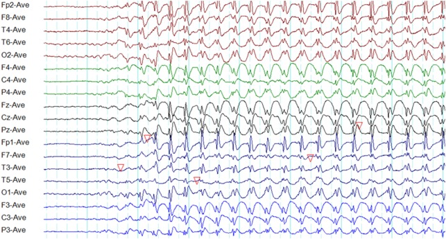 Figure 5