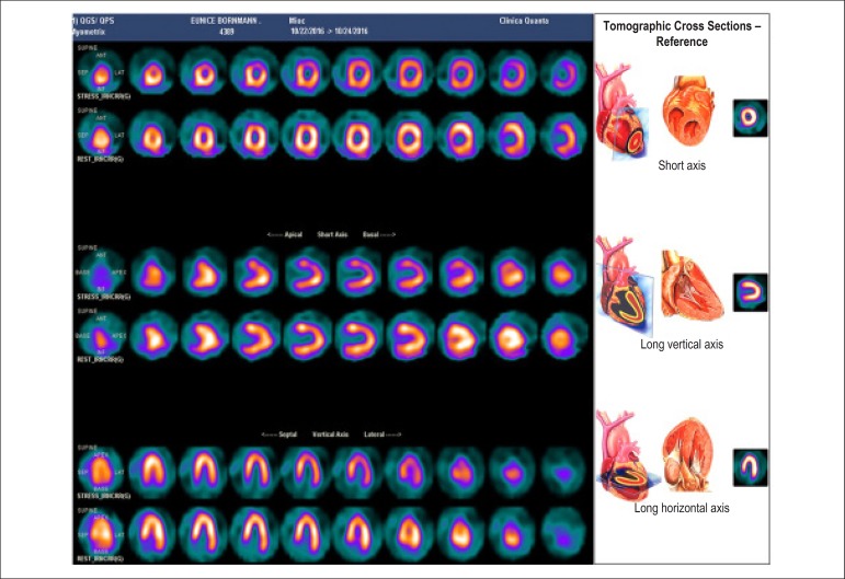 Figure 47