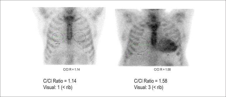 Figure 62