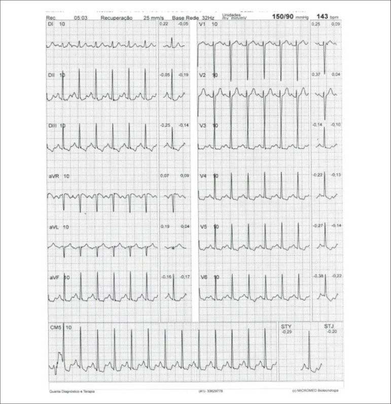 Figure 33