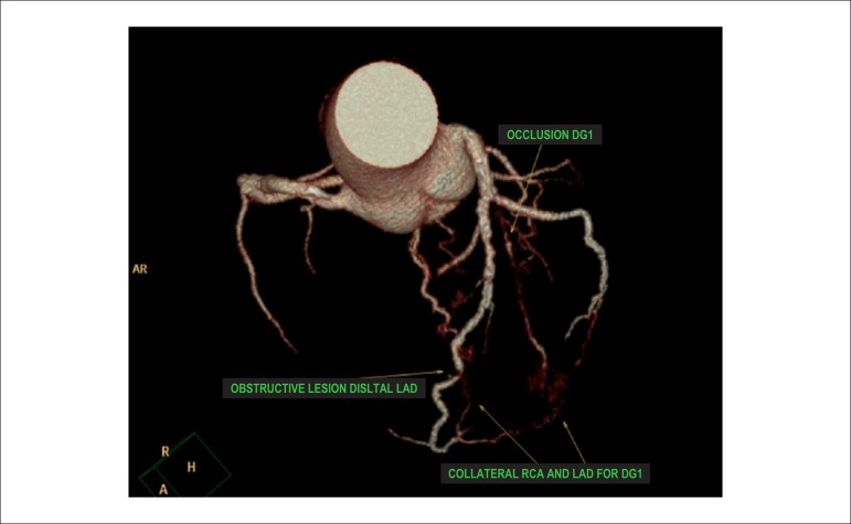 Figure 38