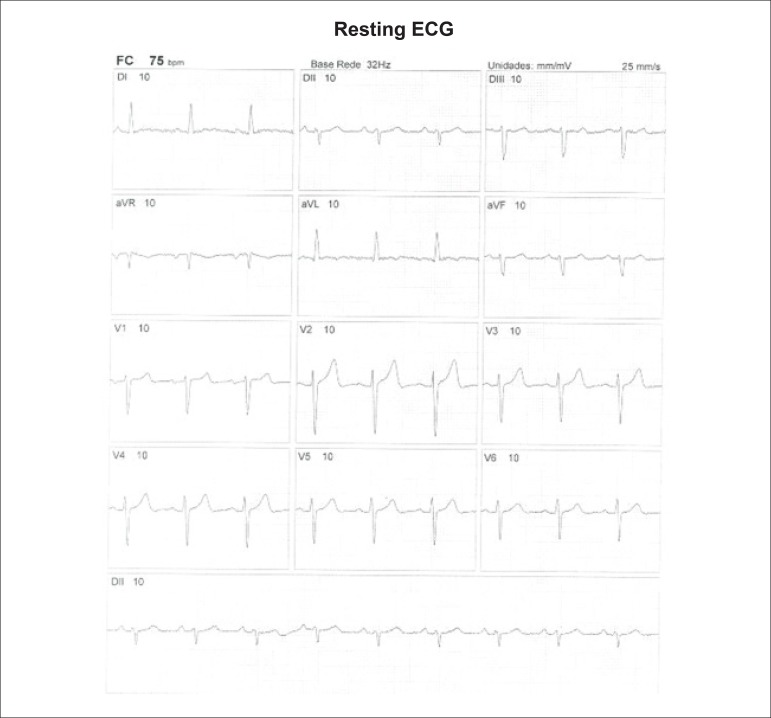 Figure 23