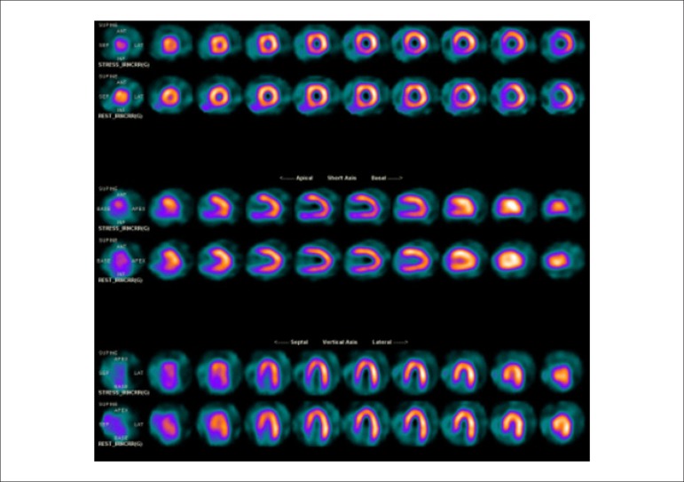 Figure 42