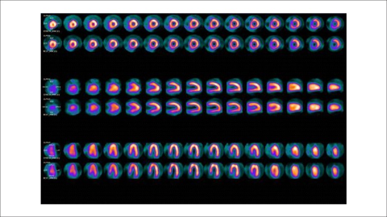 Figure 39