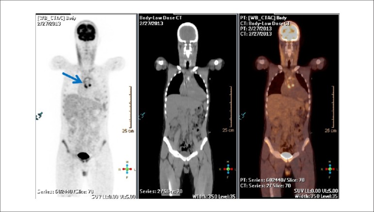 Figure 58