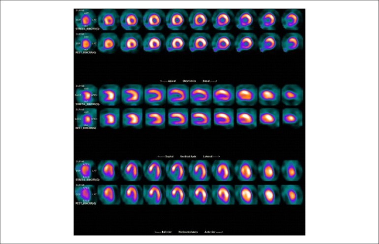 Figure 26