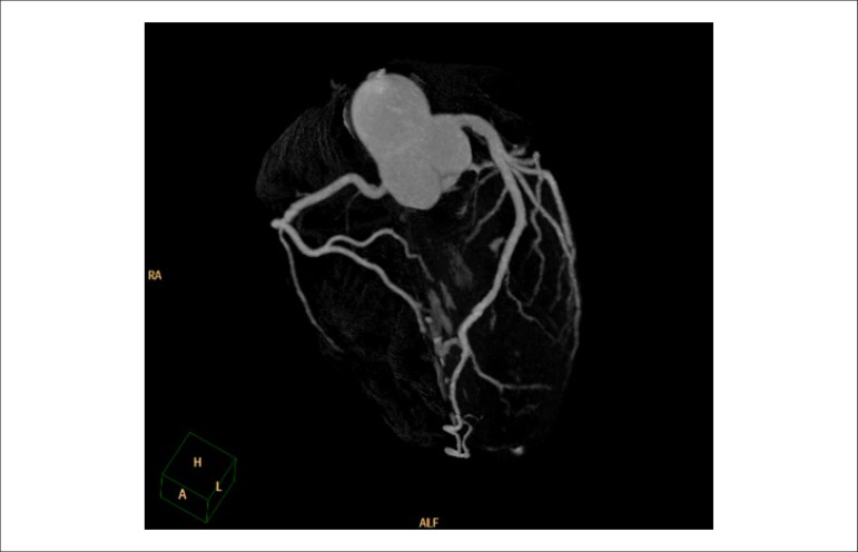 Figure 35