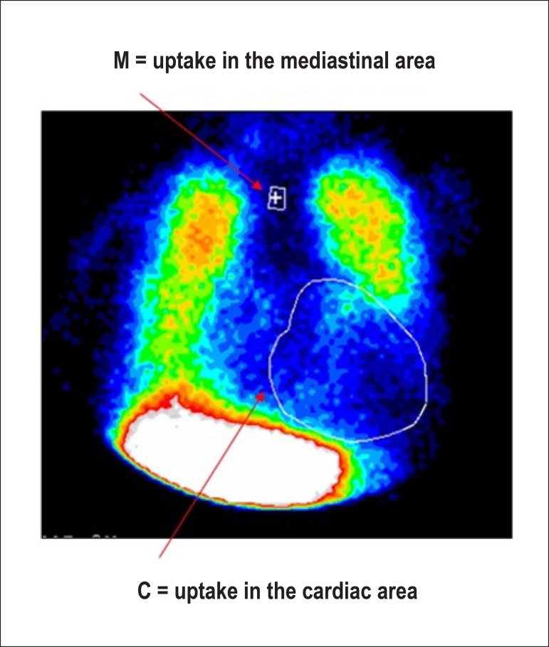 Figure 52