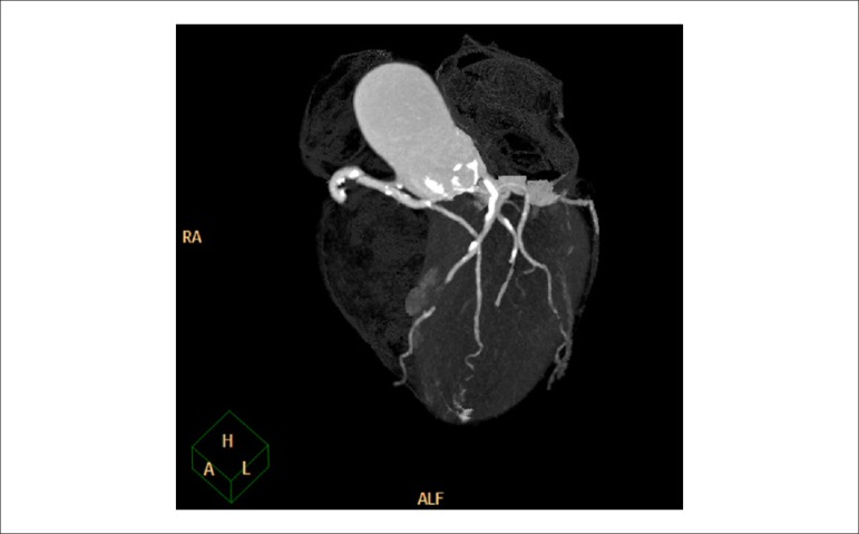 Figure 45