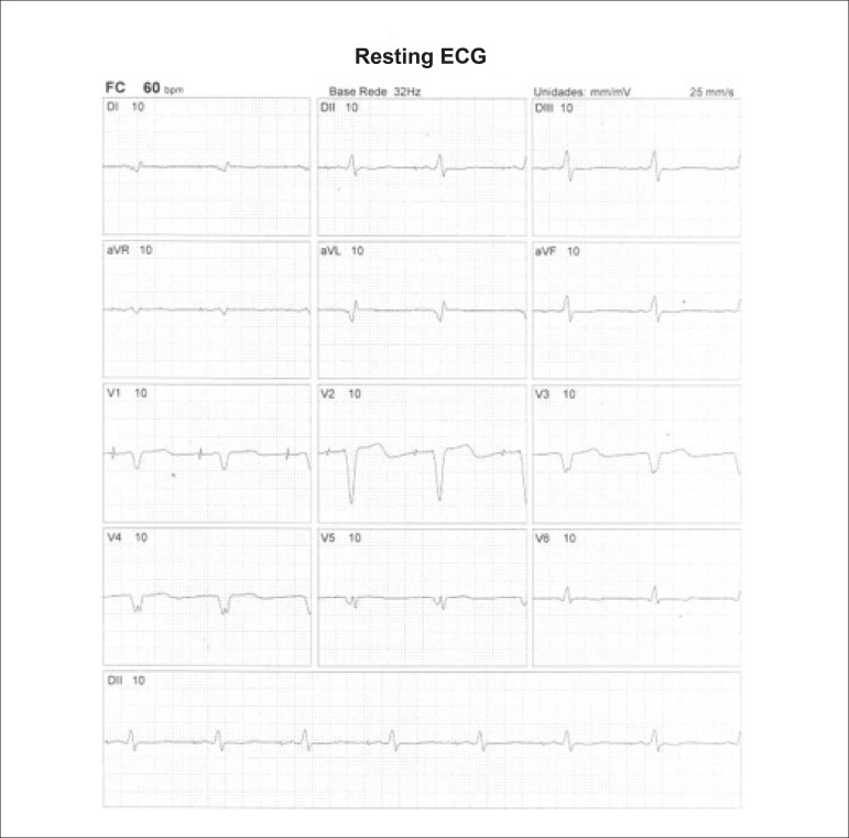 Figure 36