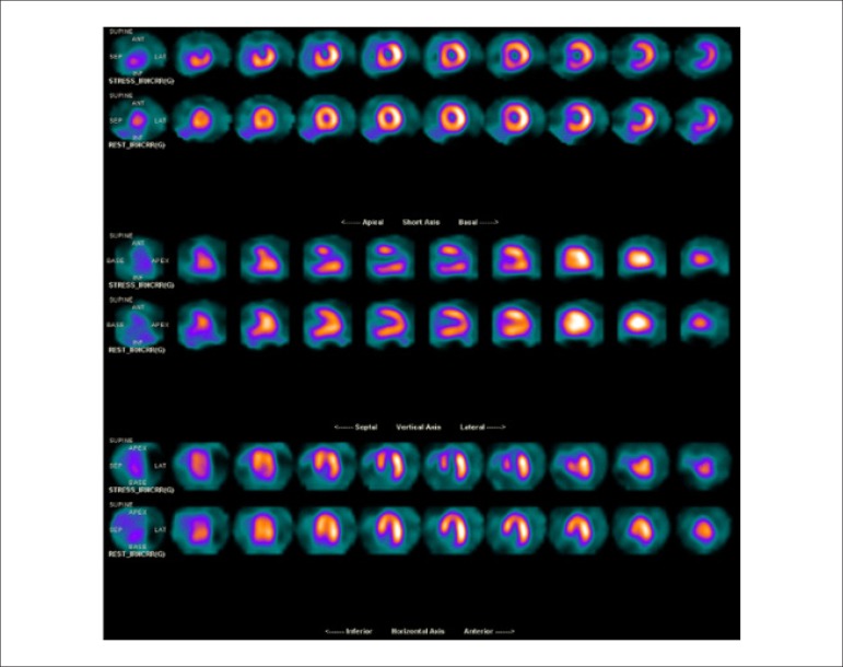 Figure 32