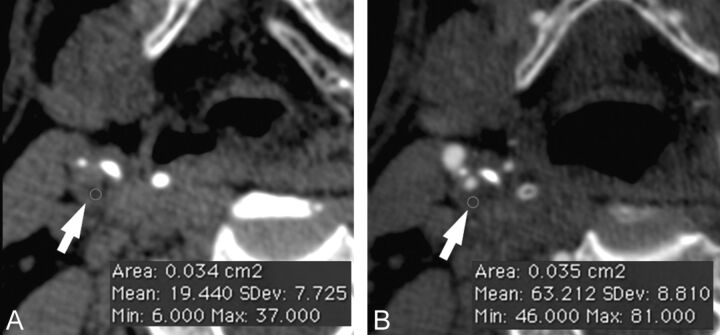 Fig 1.