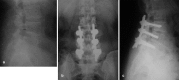 Fig. 1a–c