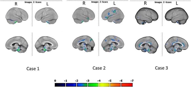 FIGURE 1