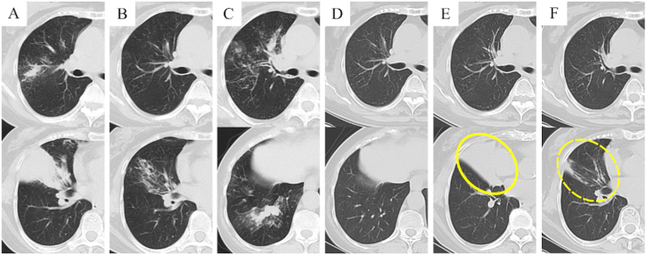 Fig. 3