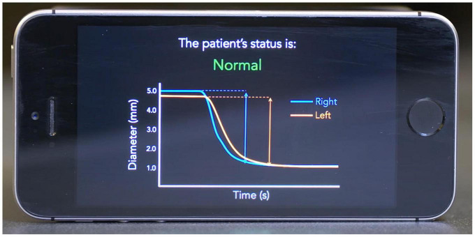 FIGURE 1