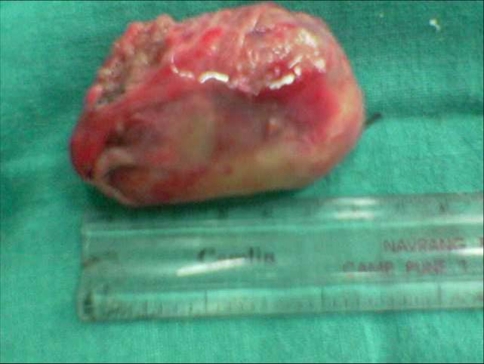 Fig. 4