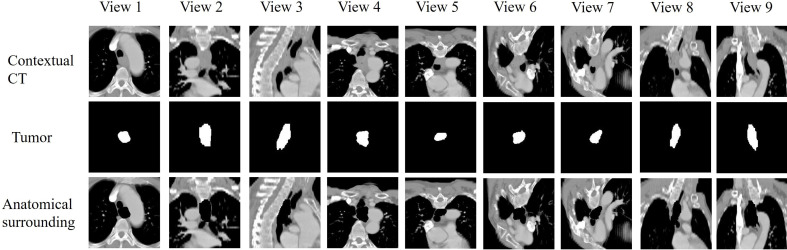 Figure 1