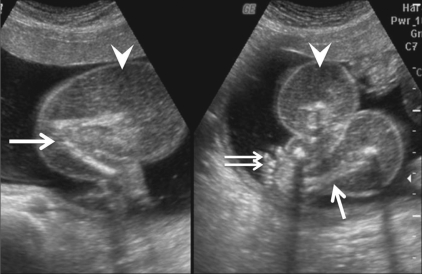 Figure 2 (A, B)