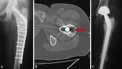 Fig. 4A–C