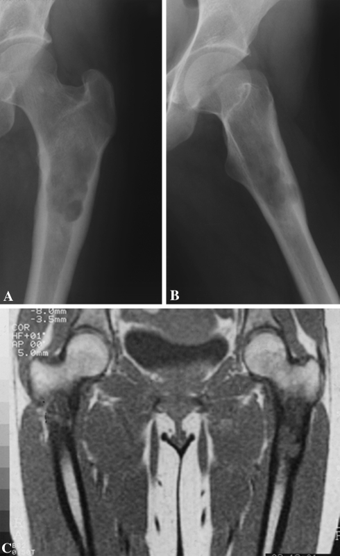 Fig. 2A–C