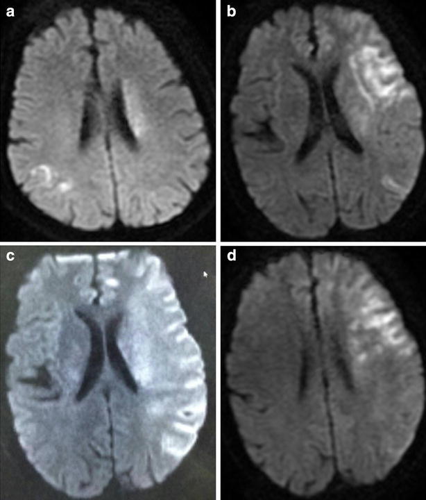 Fig. 1