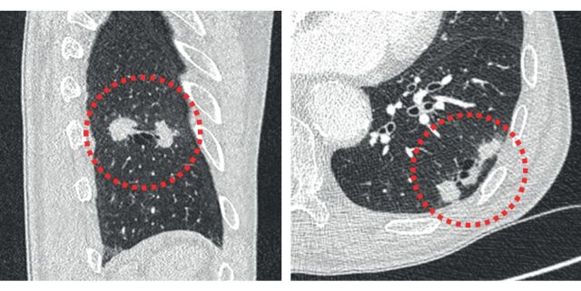 FIGURE 3