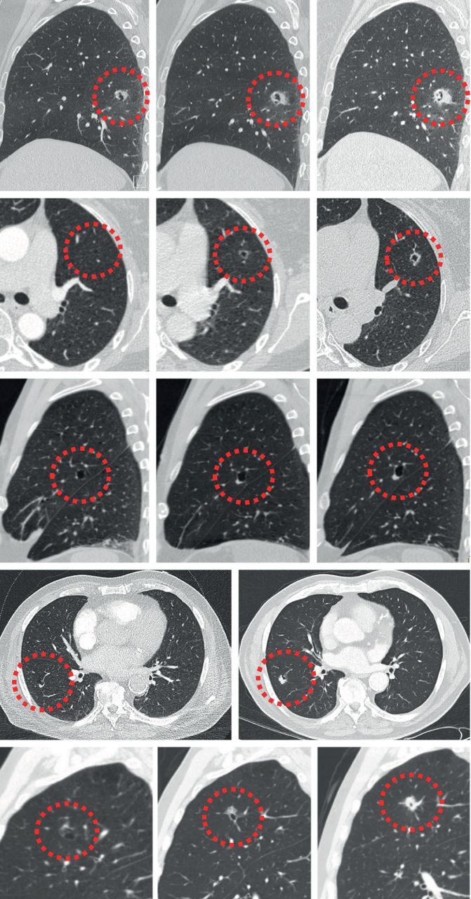 FIGURE 11