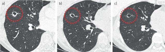 FIGURE 10