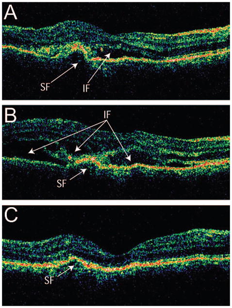 Figure 22