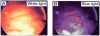Figure 13