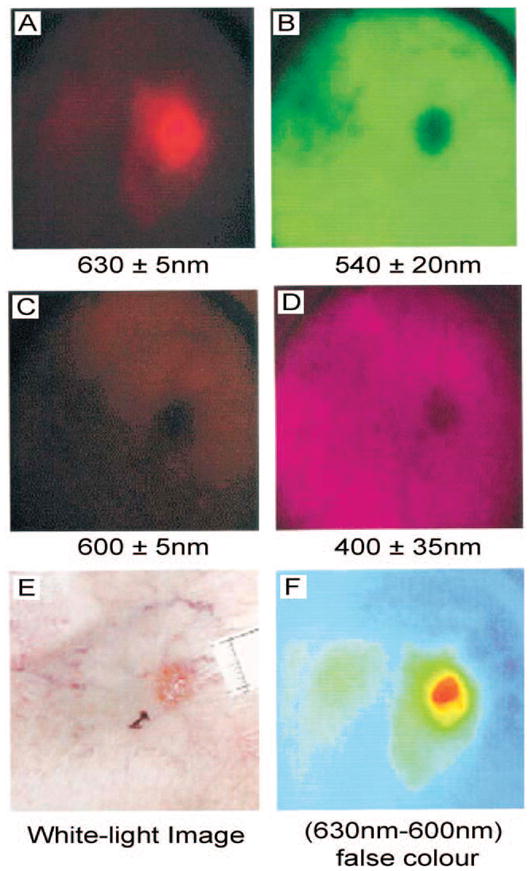 Figure 15