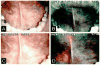 Figure 17