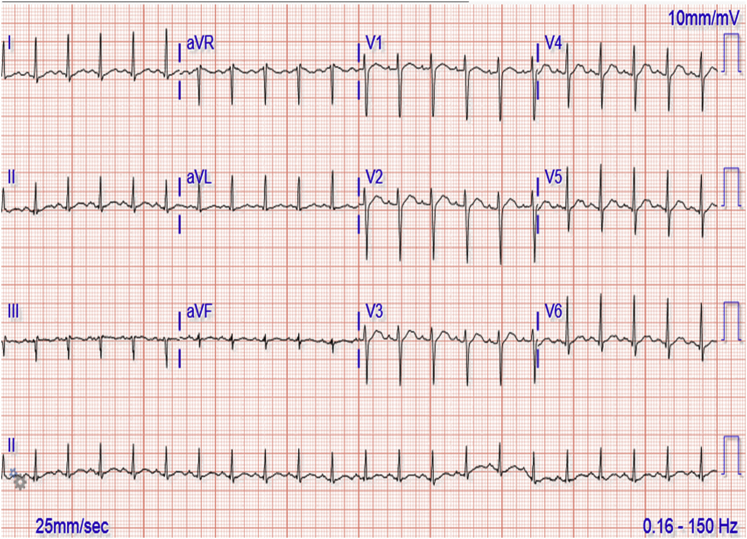 Figure 1