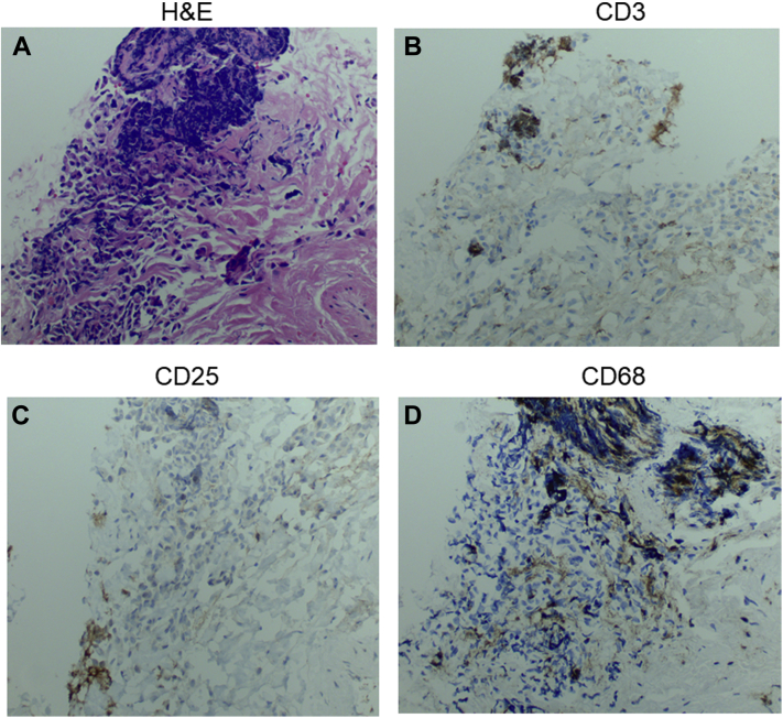 Figure 4