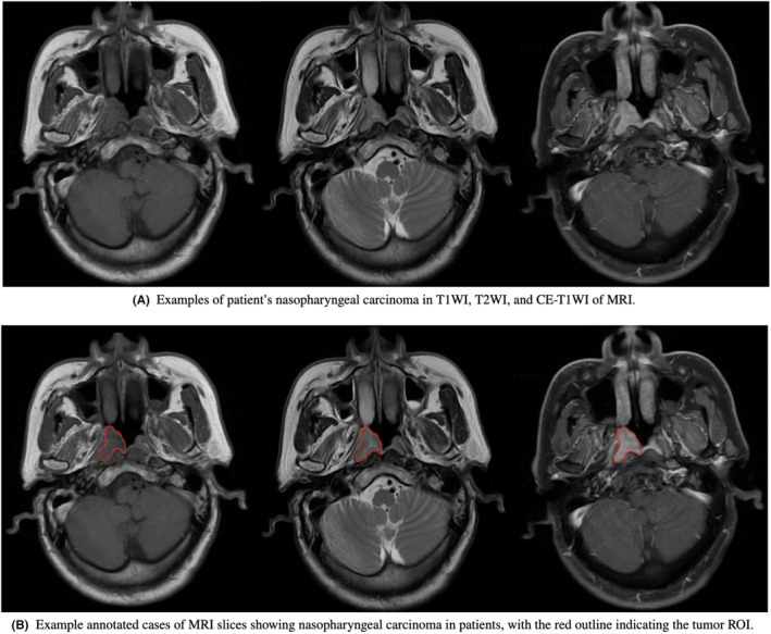 FIGURE 2