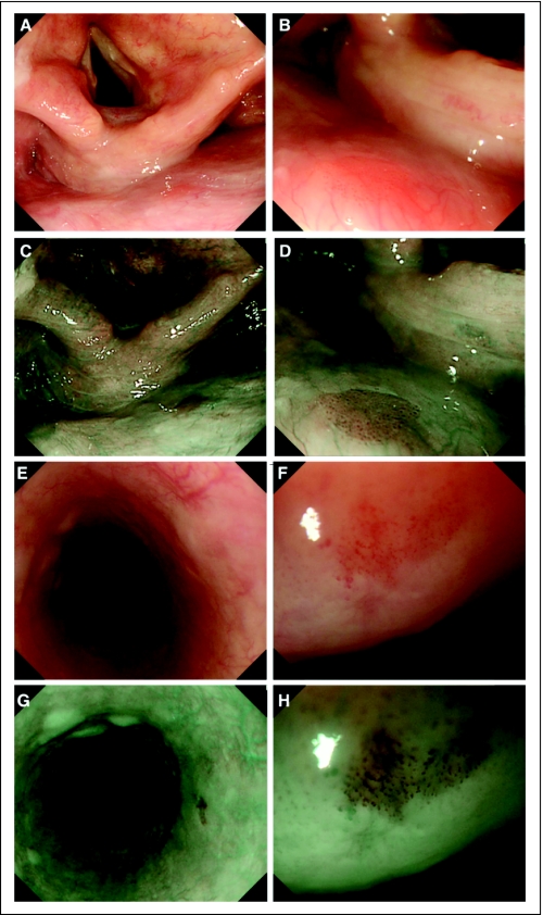 Fig 2.