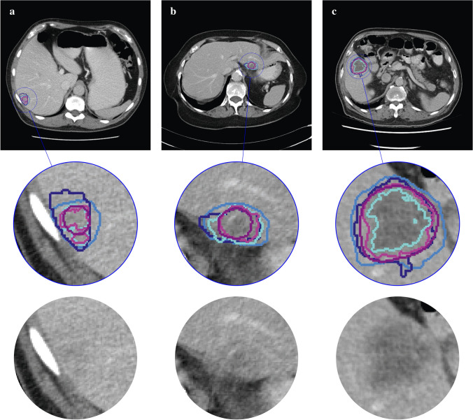 Fig. 3