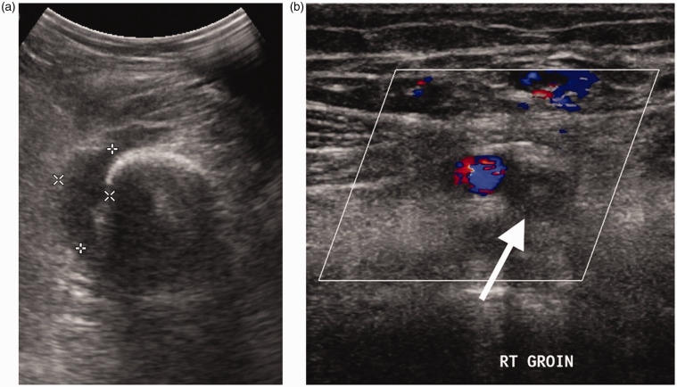 Figure 13.