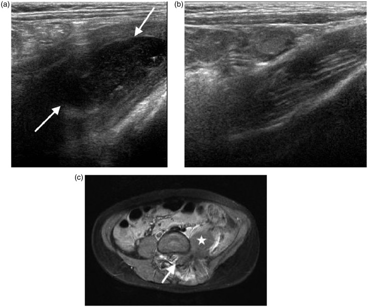 Figure 14.