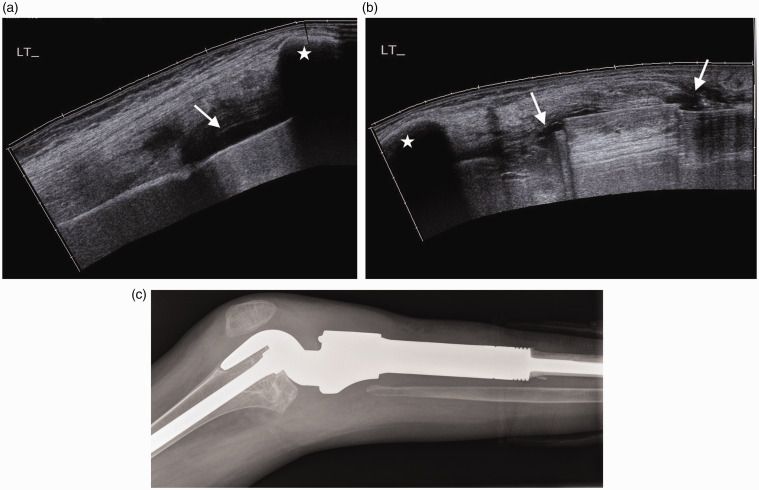 Figure 18.