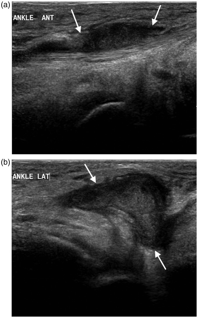 Figure 17.