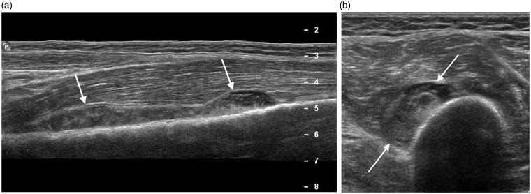 Figure 12.