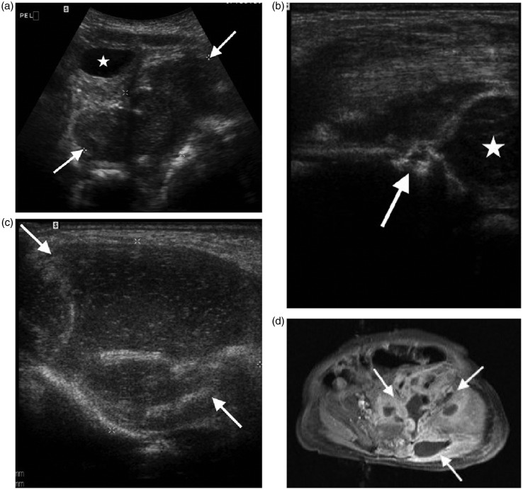 Figure 11.