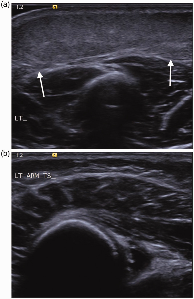 Figure 16.